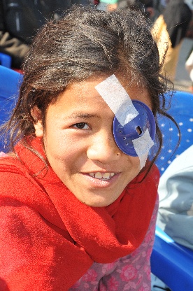 Anita, post-surgery, with her eye patch